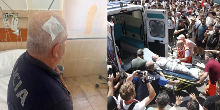 Dhuna para Parlamentit, 11 protestues dhe 6 efektivë paraqiten në QSUT dhe te Trauma, ja gjendja e tyre